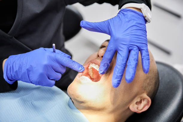 Best Emergency Root Canal Treatment in Pittsville, MD